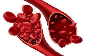 Qué es la anemia?